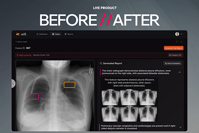 Redesigning AI-Powered Radiology Interface ai copilot best design agency best product design agency best ux designer on dribbble bottomlineux ct scan dark mode imaging mafruh mecha health medical tech neorology radiology saas saas design agency saasfactor sohag ux design y combinator