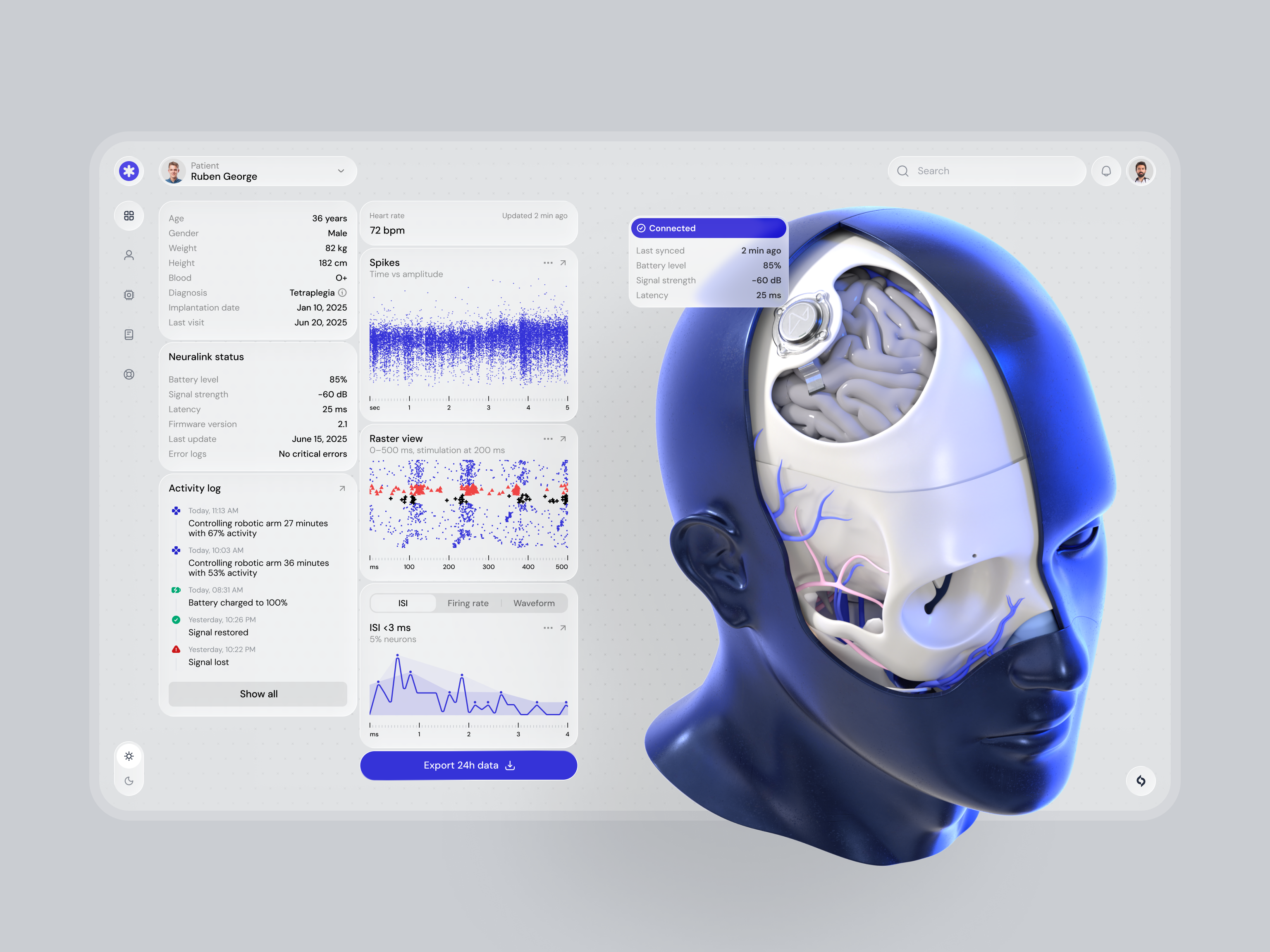 Dashboard Design for Neural Implant Monitoring brain monitoring device monitoring implant implant dashboard implant monitoring monitoring neural neural analytics neural dashboard neural data neural implant neural interface neural monitoring neural tracking neural visualization neurological monitoring patient dashboard patient monitoring real time monitoring signal analysis