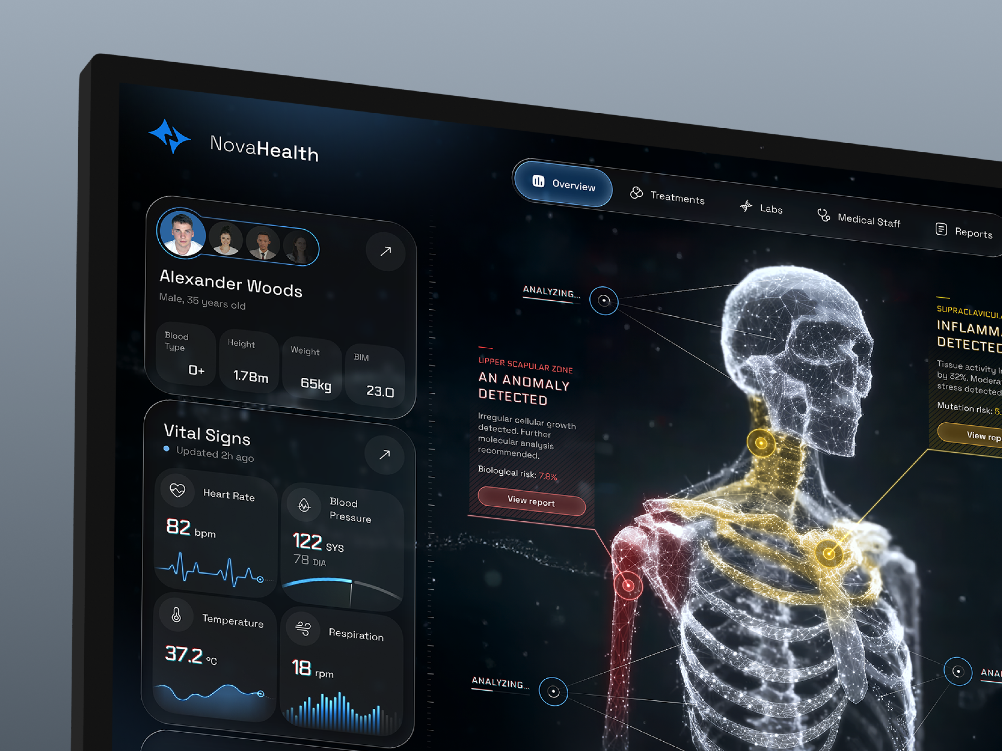 NovaHealth - Health Analysis Dashboard Concept ai ai analytics aidesign artificial intelligence dashboard datavisualization designconcept display health healthtech inspiration liquid glass medical ui minimalism panel dashboard product design technology uiux web app