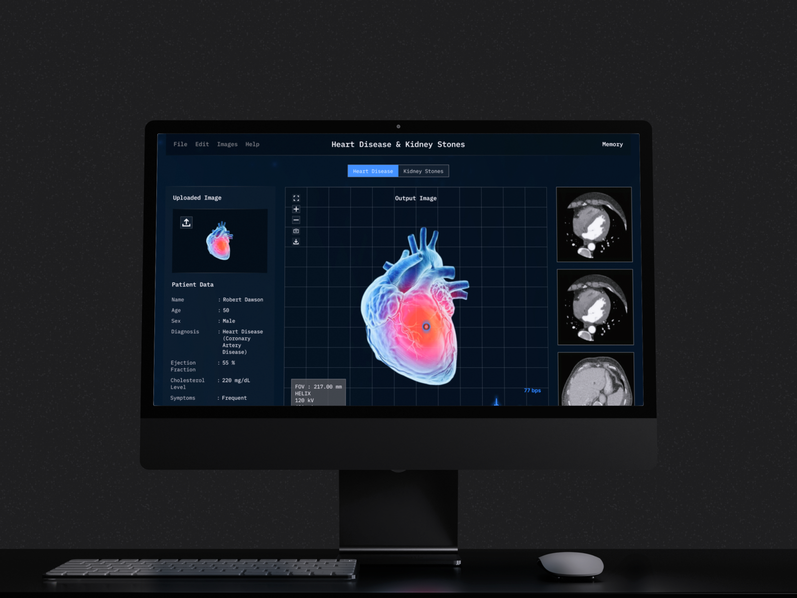 CT Scan Diagnostic Desktop App 3d visualization ai detection ui brain scan ct scan dark mode ui data visualization desktop app diagnostic tool healthcare design healthtech heart scan hospital software interface design medical dashboard medical imaging medical ui modern ui radiology app ui concept ux design