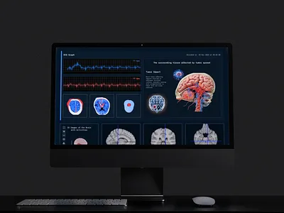 CT Scan Diagnostic - Brain Tumor ai diagnosis brain scan ct scan app dark mode design data visualization desktop app ui diagnostic tool healthcare design healthtech hospital software interface design medical dashboard medical imaging medical technology medical ui mri ui neurology ui radiology software tumor detection ux concept