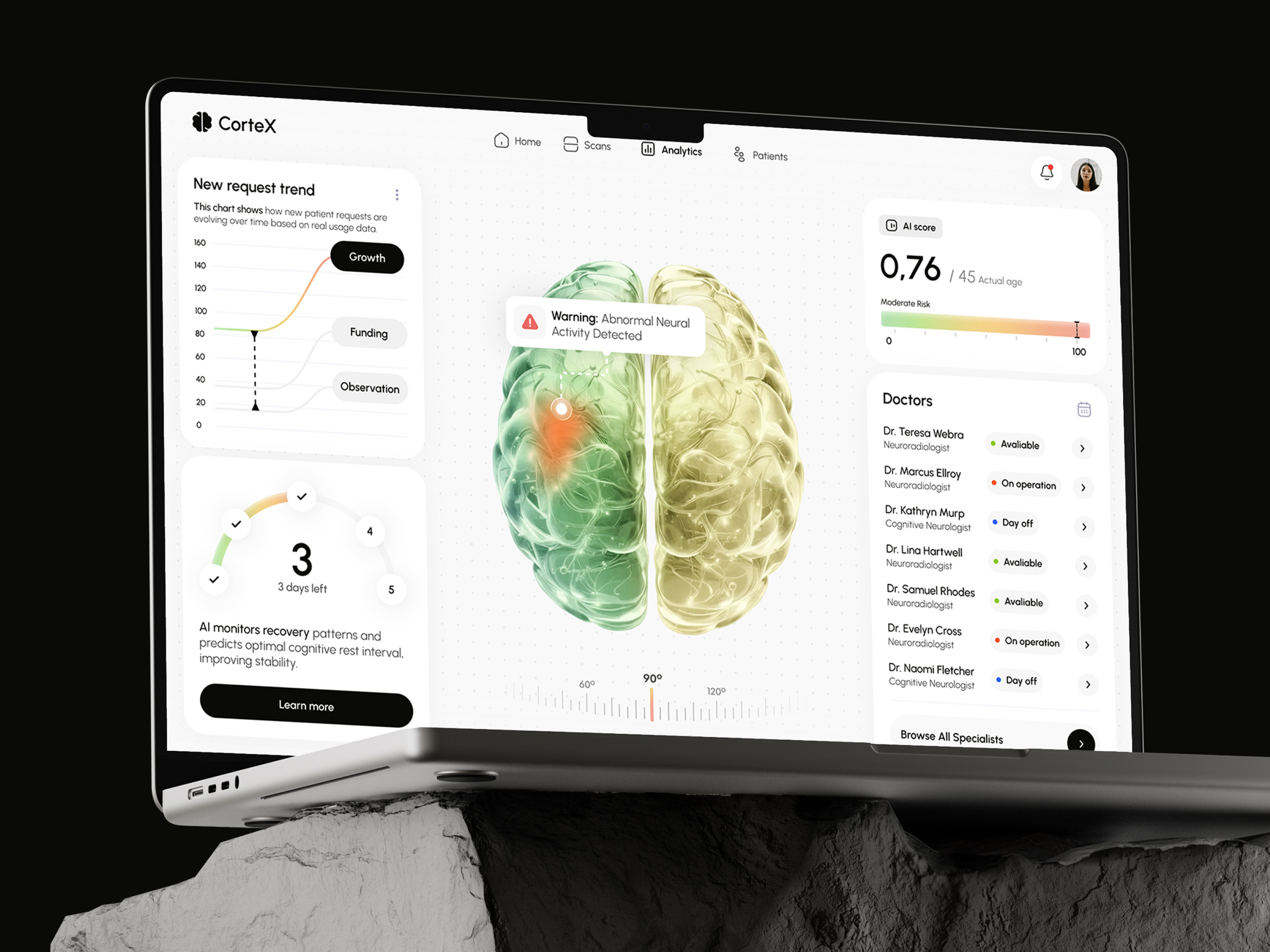 Example of CorteX - neuro analytics platform