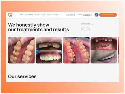 Before/after cases on the dental clinic's website cases design ui ux web design website
