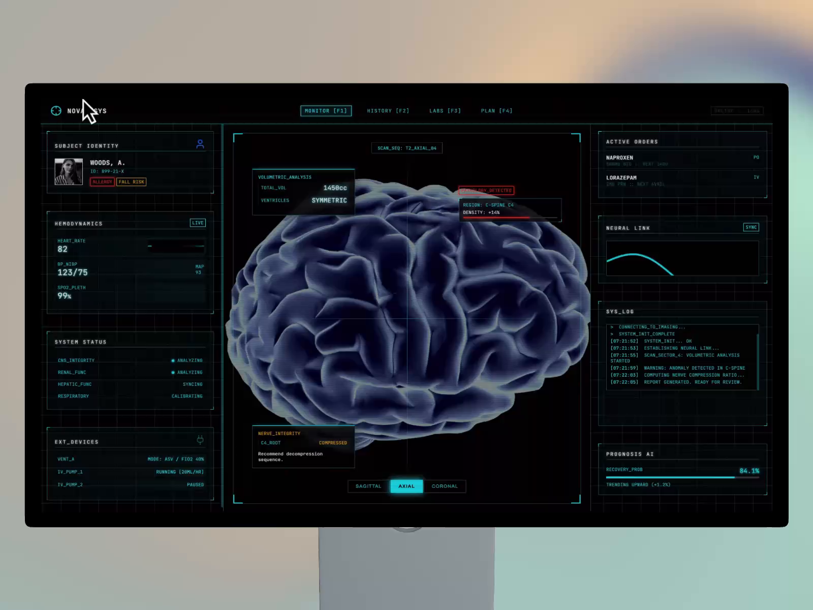 Example of Medical AI Interface UI – Neural Diagnostics & Monitoring System