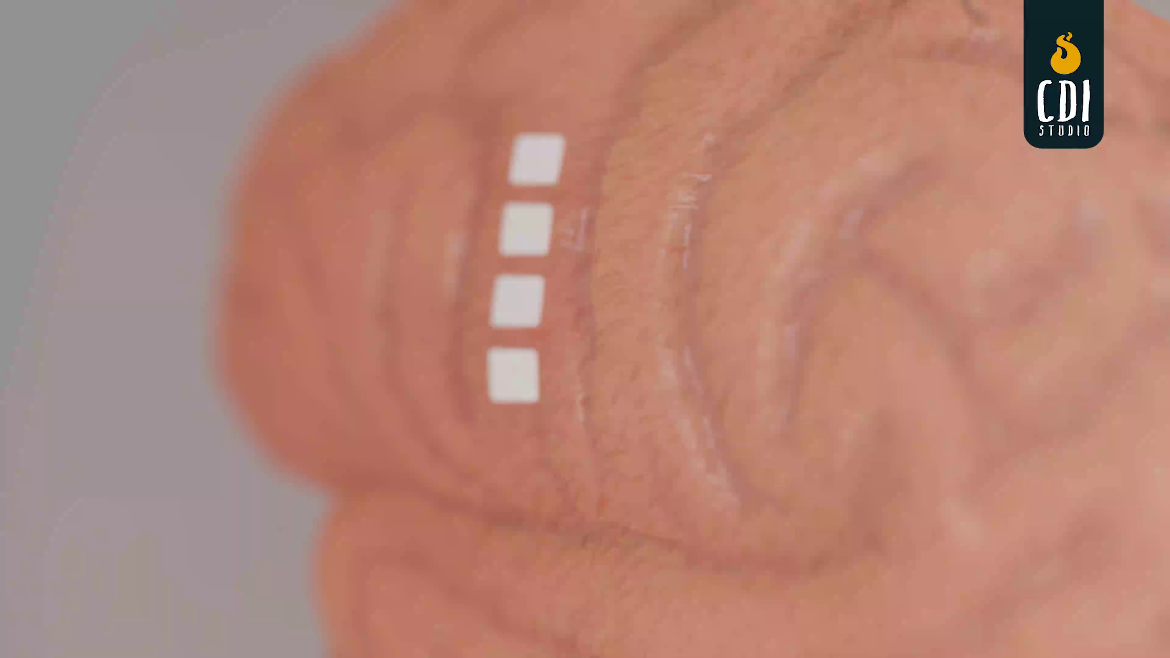 Example of Medical Animated Video