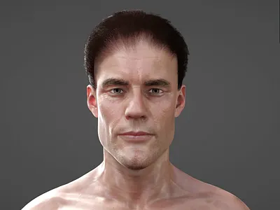 3D Animated Video of showing a Hair loss in men via DHT 3d 3d animation animated video medical animation