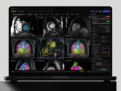 Cardiac MRI Scan Analysis ai medical ai product callour cardiac mri cardiology clinical software dark ui dashboard data visualization diagnostic healthcare healthcare saas heart analysis medical medical imaging mri scanner product design radiology ui saas ui