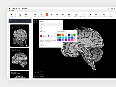 Vision AI — Medical Imaging Interface Concept design figma medical app mri app product product design ui ux