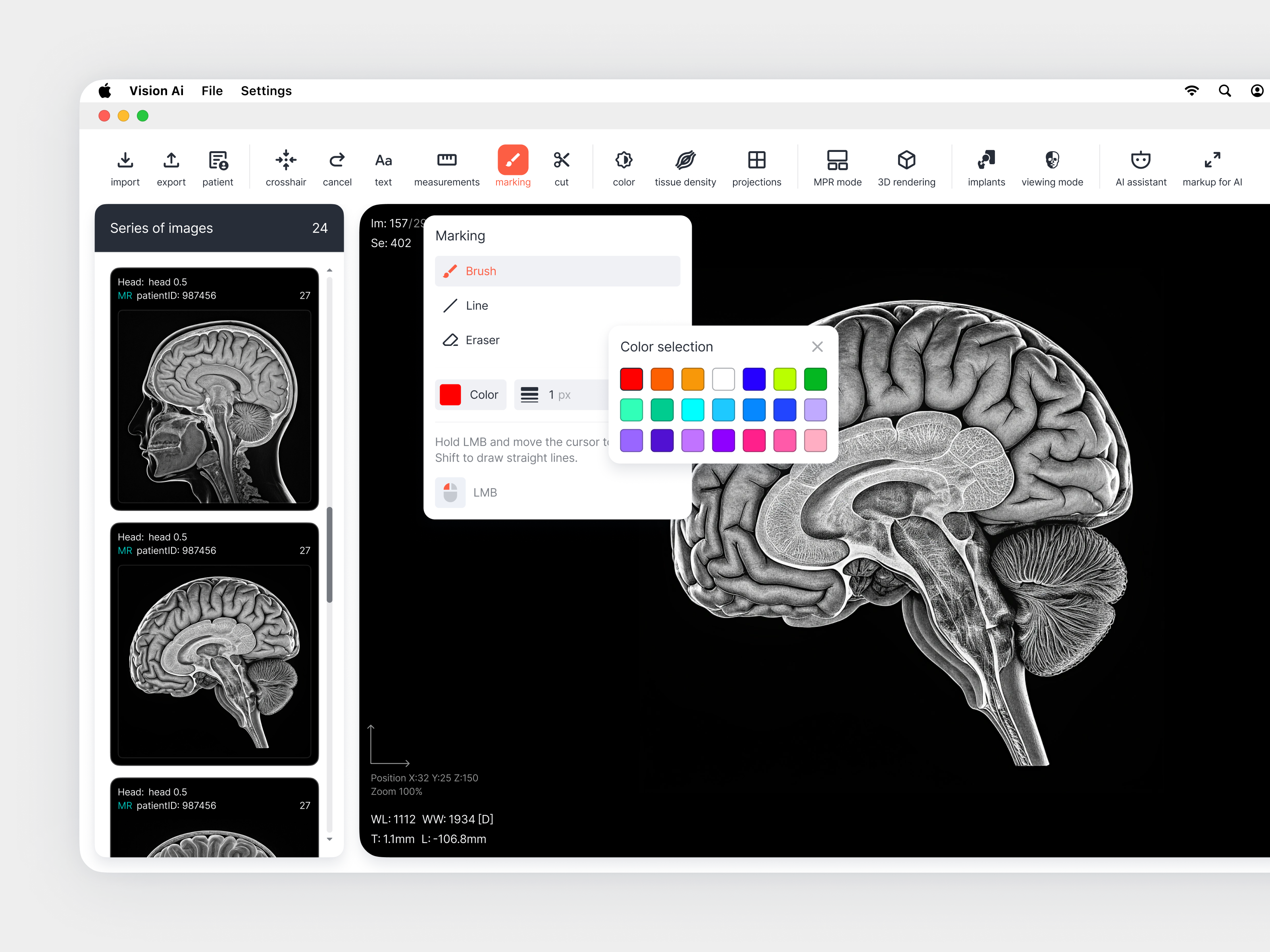 Vision AI — Medical Imaging Interface Concept