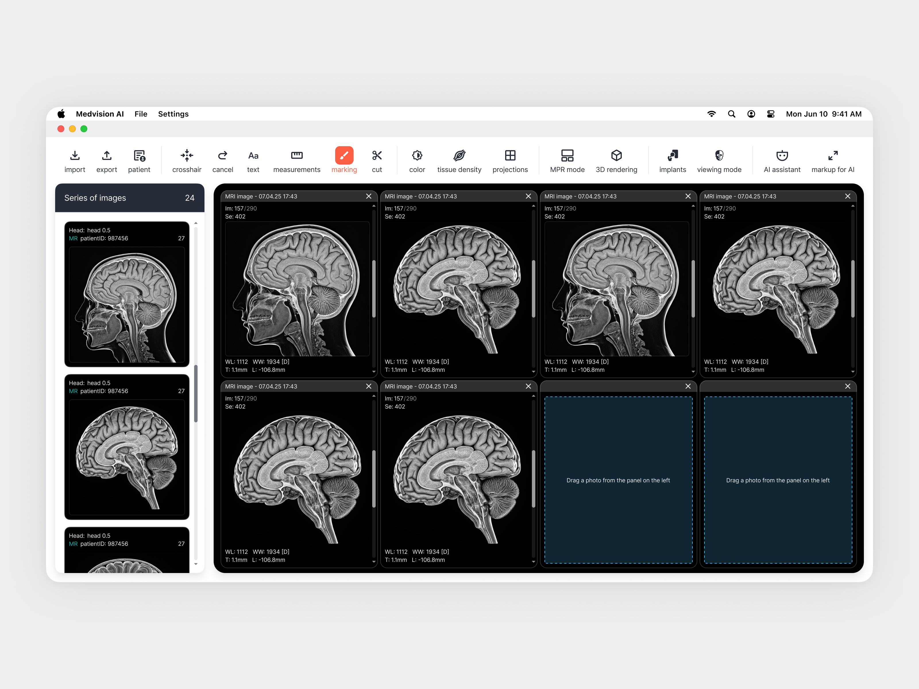 Vision AI — Medical Imaging Interface Concept