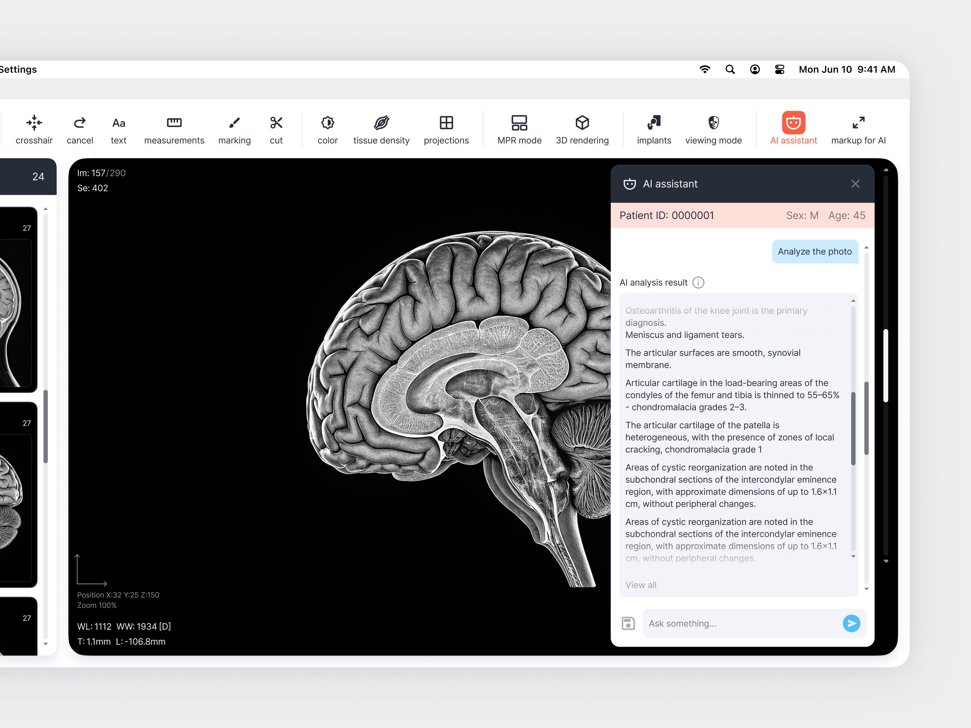 Vision AI — Medical Imaging Interface Concept design figma medical app mri app product design ui ux