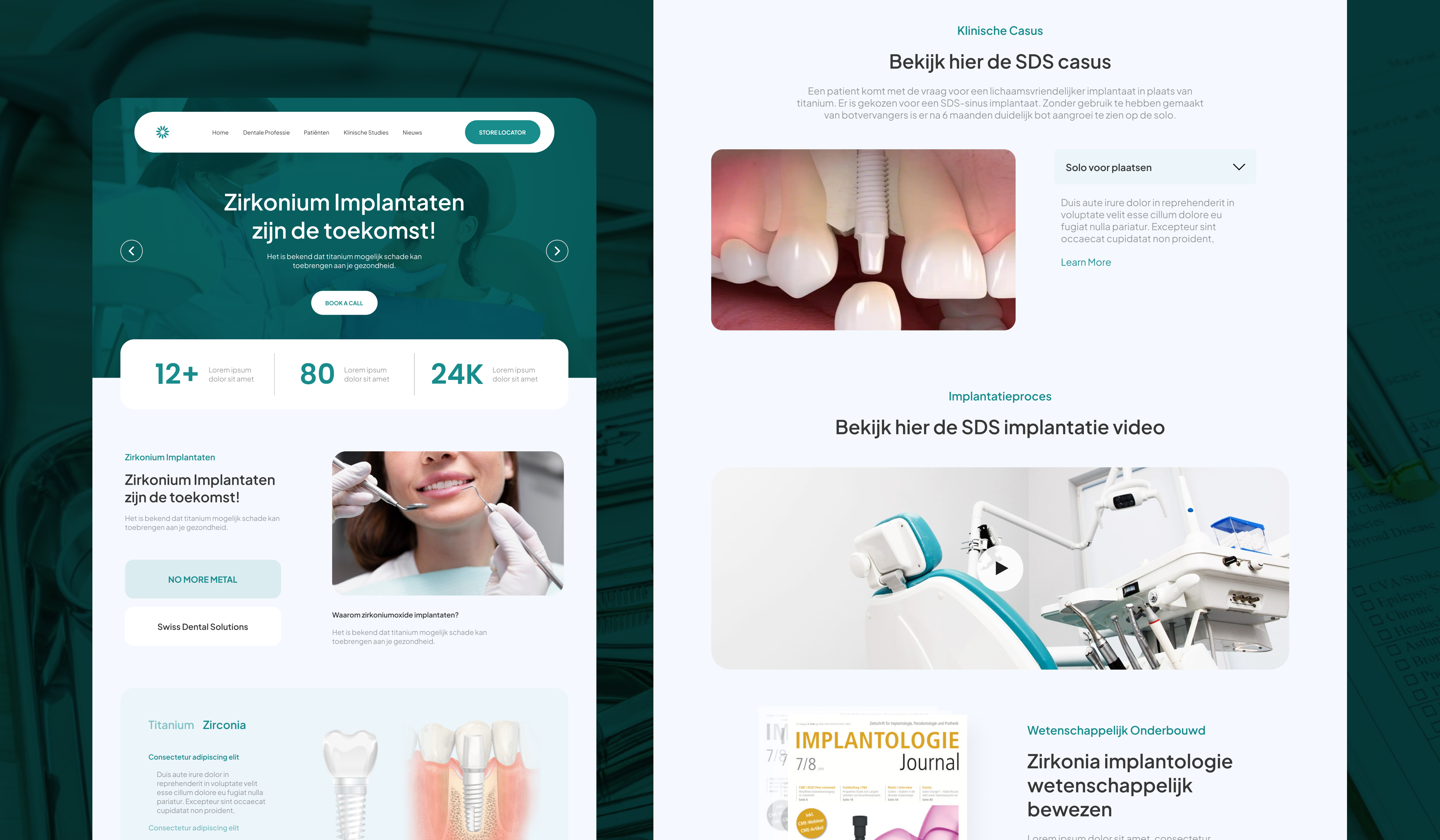Zirkonium Implantaat - UI Web Design branding clinic clinical dental dental web figma figma prototype graphic design ui uiux web design