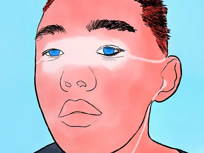 “Sunburn” illustration design illustration