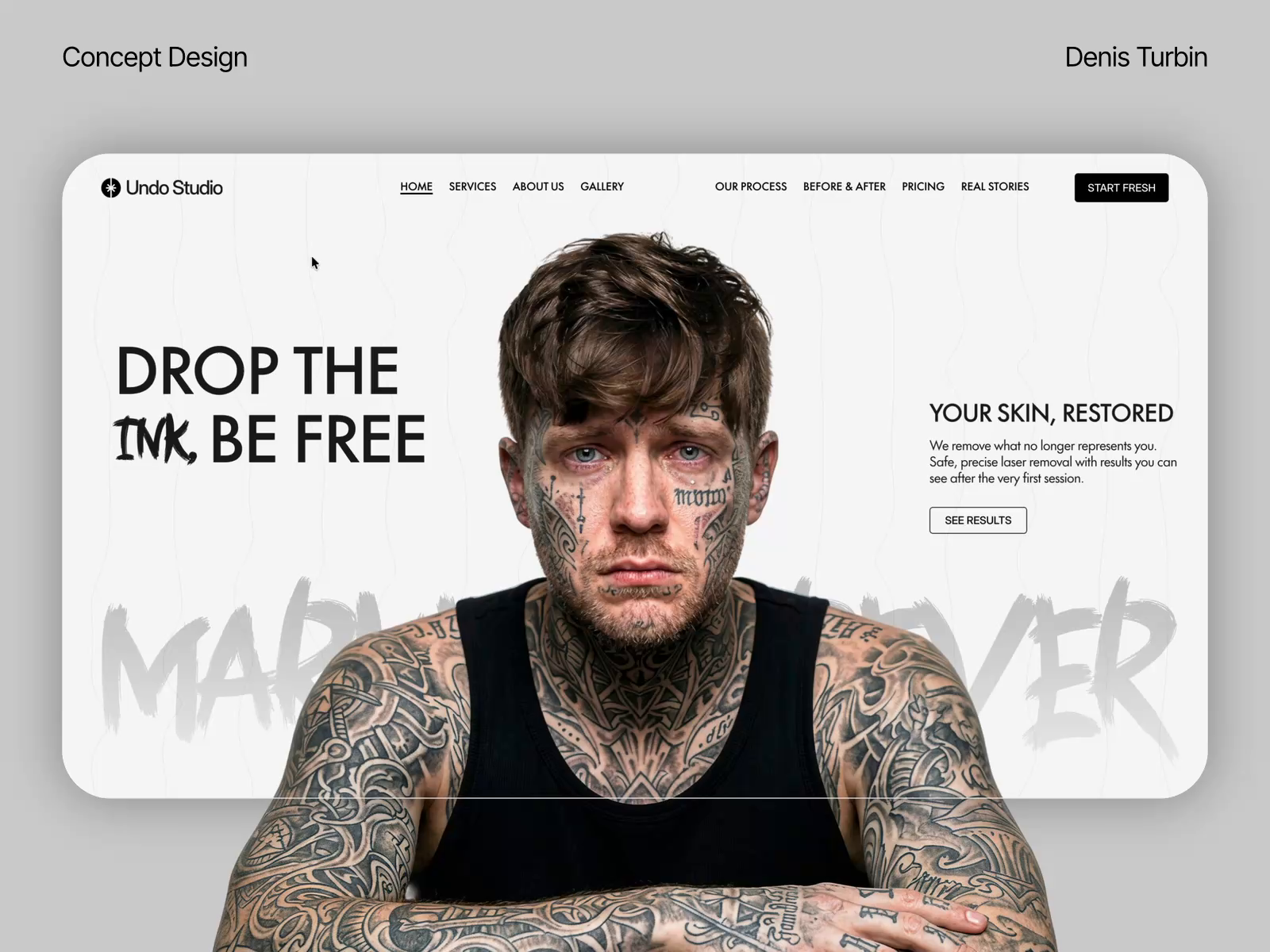 Tattoo Removal Landing Page Concept