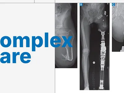 HSS Legacy | Complex Care after effects animation branding complex care grid grid animation grid system health healthcare hss image animation medical medical animation motion design motion graphics parallax photo animation photography responsive grid surgery