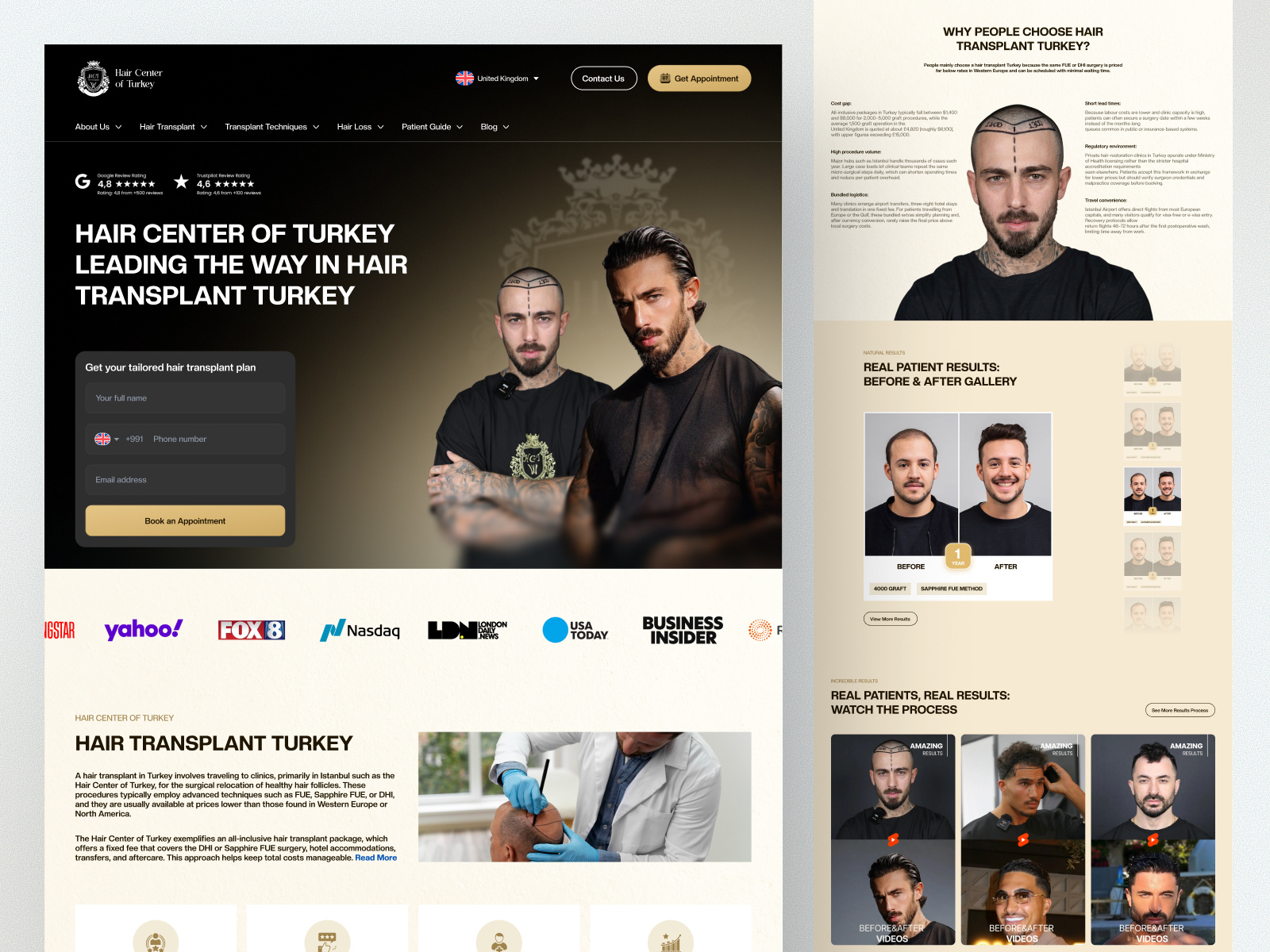 Hair Center of Turkey – Hair Transplant Website Design Redesign aesthetic clinic before after showcase clinic marketing website clinic website conversion focused hair clinic hair transformation hair transplant hair transplant clinic hair transplant website hair treatment hair turkey healthcare website design medical landing page medical service website patient experience design transplant website turkey hair transplant uiux redesign website redesign