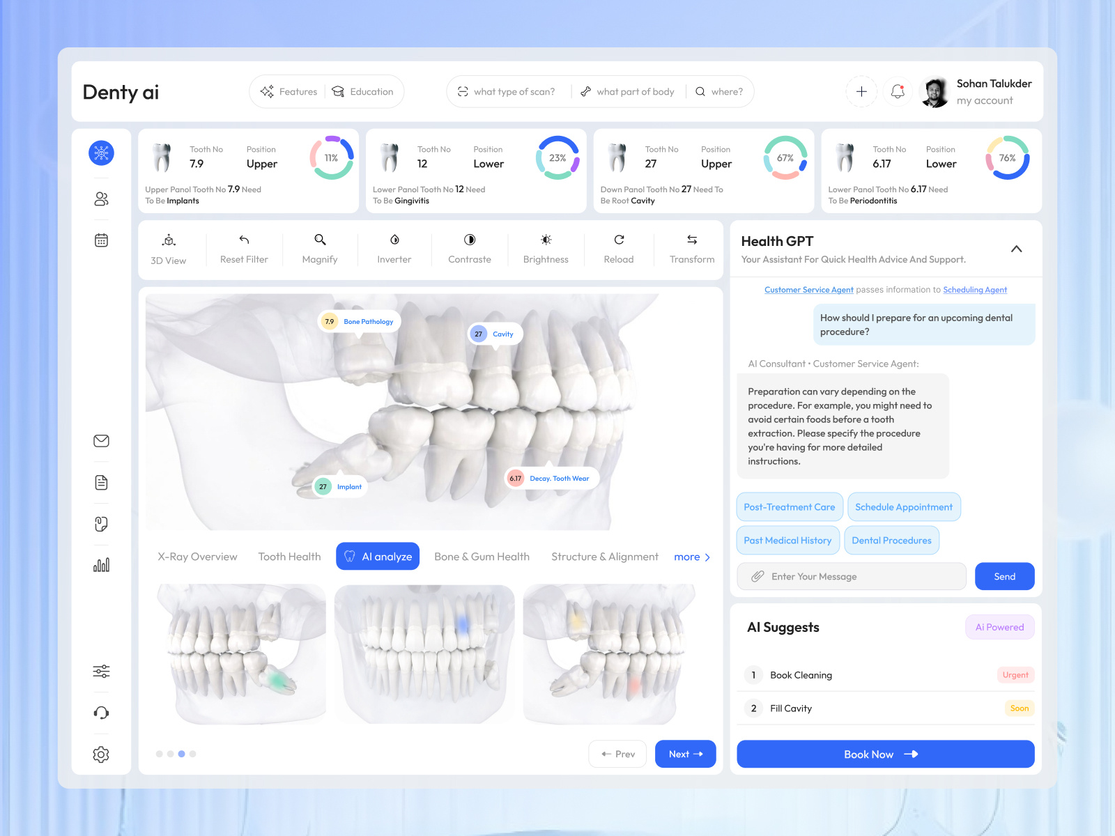 Dental AI Analysis Dashboard Design ai assistant ai dashboard analytics artificial intelligence clinical dashboard dental analysis dental care dental dashboard dental health dashboard dentist dentist ai dashboard denty ai dashboard health dashboard medical dashboard patient dashboard product design software teeth xray tooth analysis ui ux design