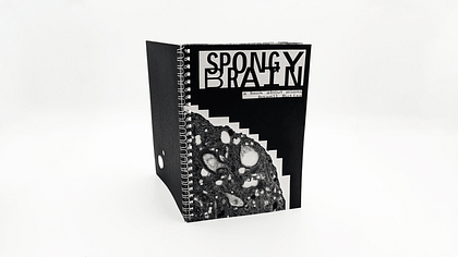 Spongy Brain