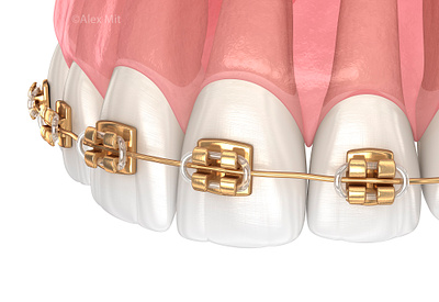 Dental braces, 3D illustration 3d braces clinic dental dental clinic dental illustration dentistry render teeth tooth