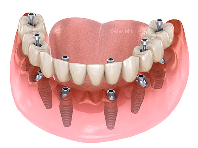 dental tooth illustration