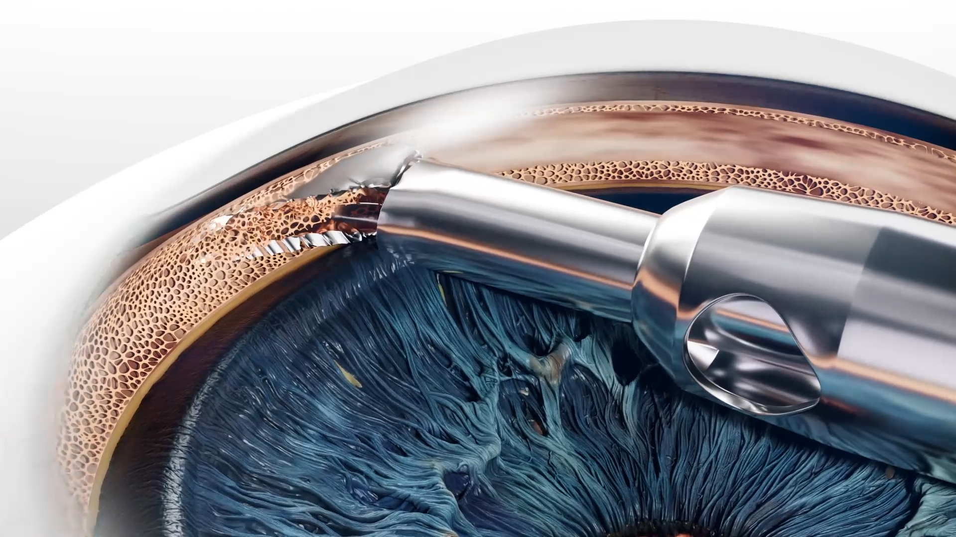 Example of Healthcare & Medical 3D Animation