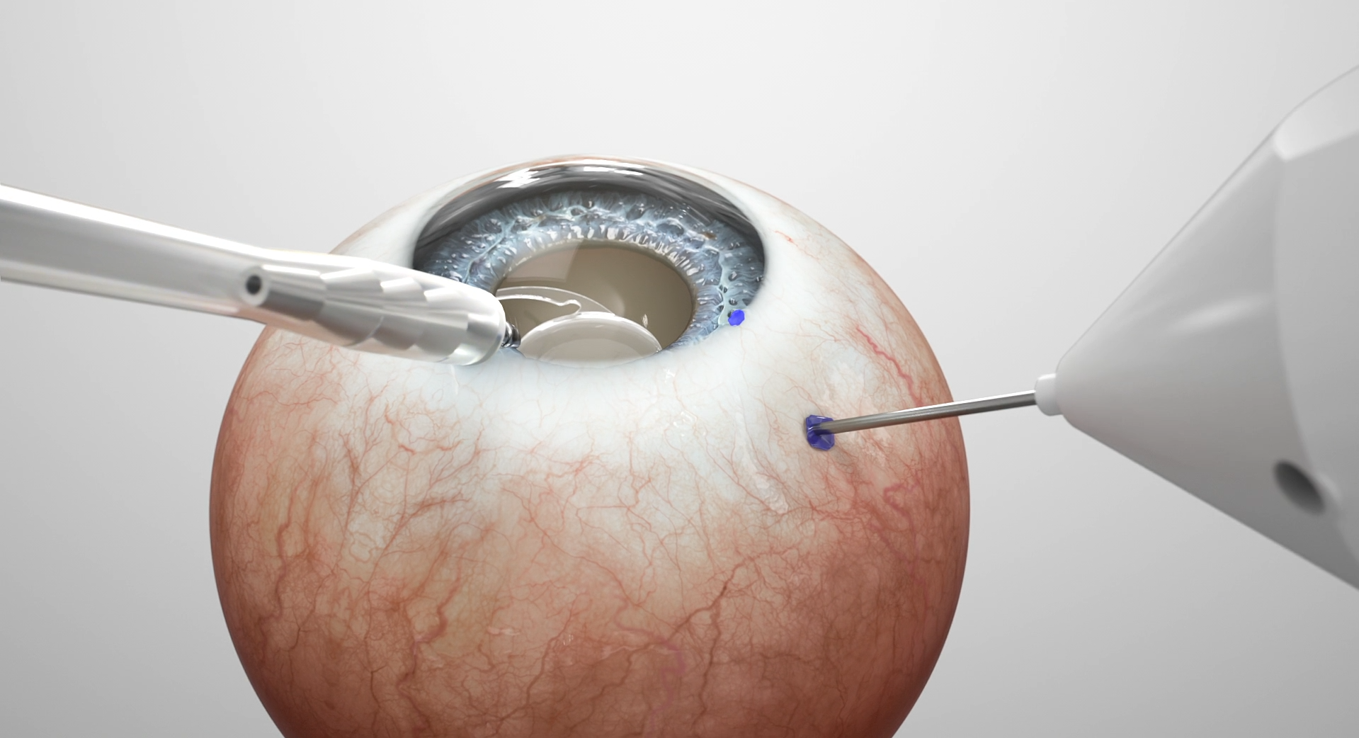Vista Surgical Tool 3d animation branding graphic design motion graphics