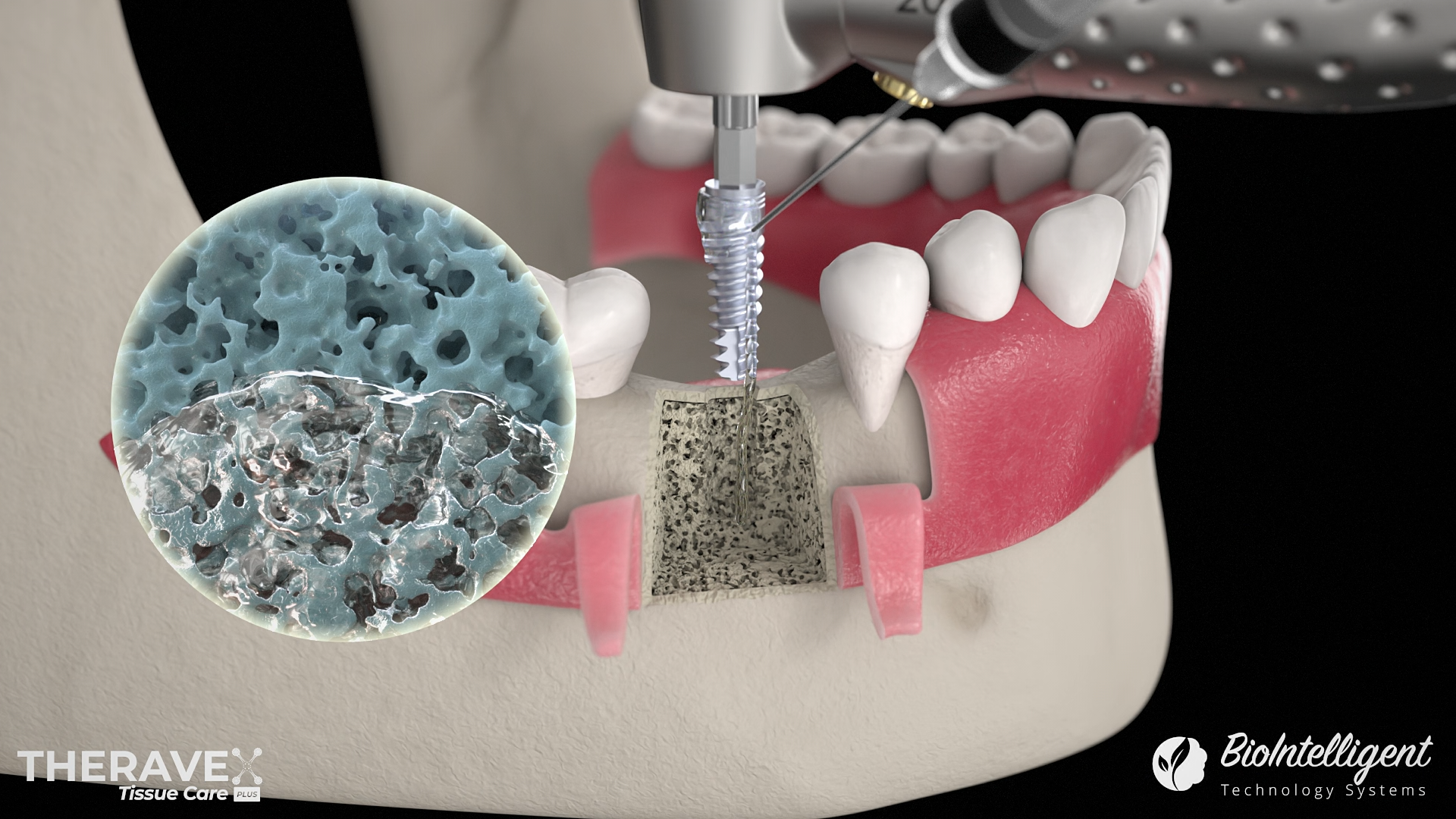 Example of Healthcare & Medical 3D Animation