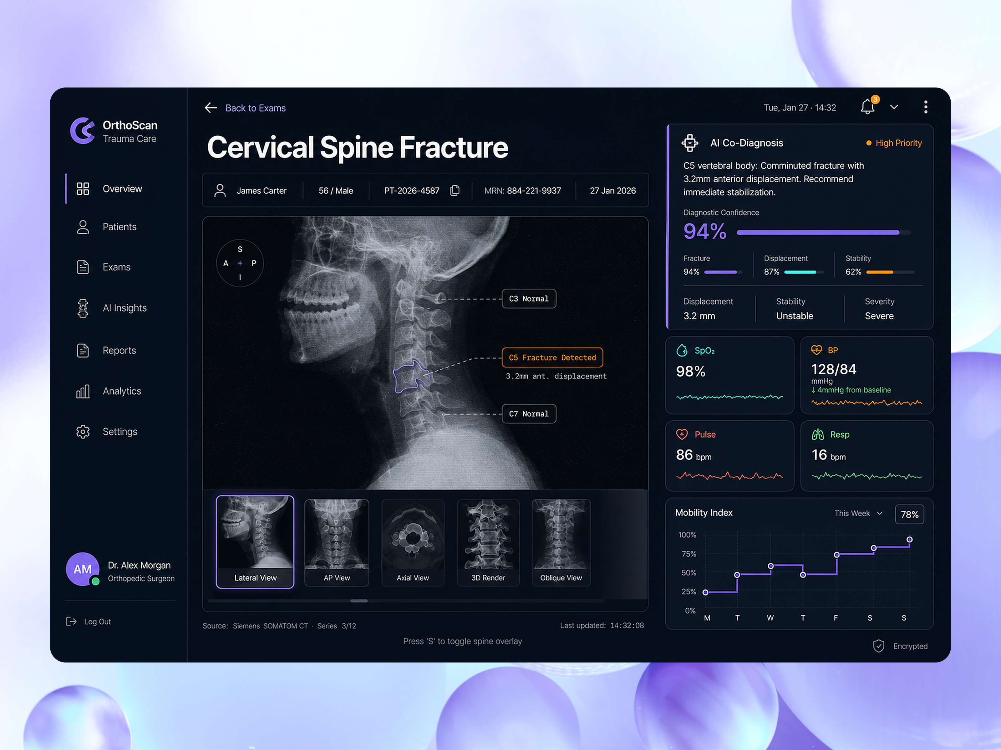 Healthtech AI Dashboard - Orthopedic Trauma Care ai ai dashboard graphic design healthcare interface product service startup ui ux web website