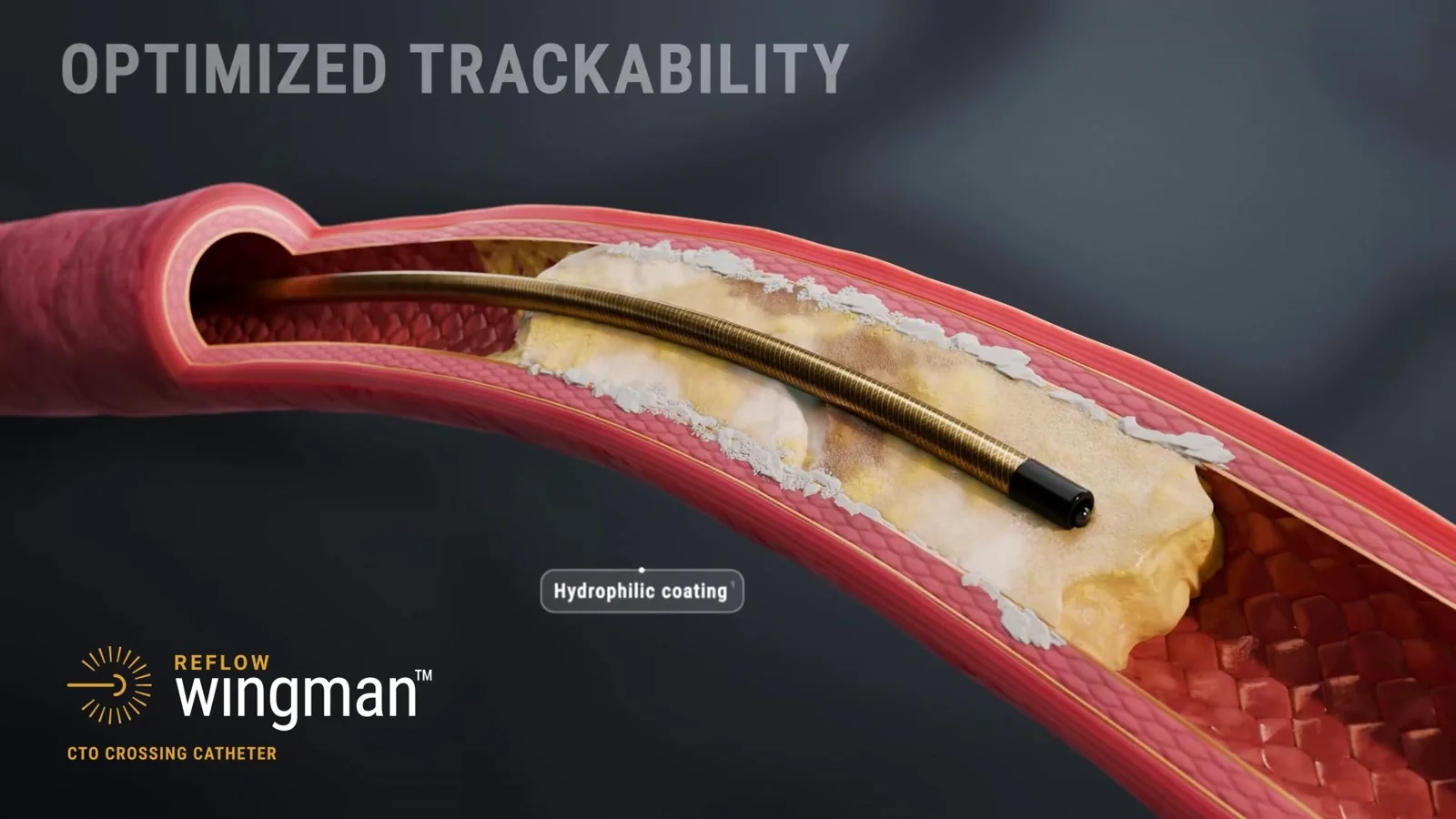 3D medical device video 3d animation blender branding device film graphic design health medical motion graphics product animation robotics video