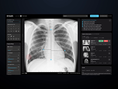 Medical Radiology Queue XR Health 3d adobe after efects animation dashboard data data visualization design designer digital figma healthcare interactions interface lungs medical radiology ui user interface ux