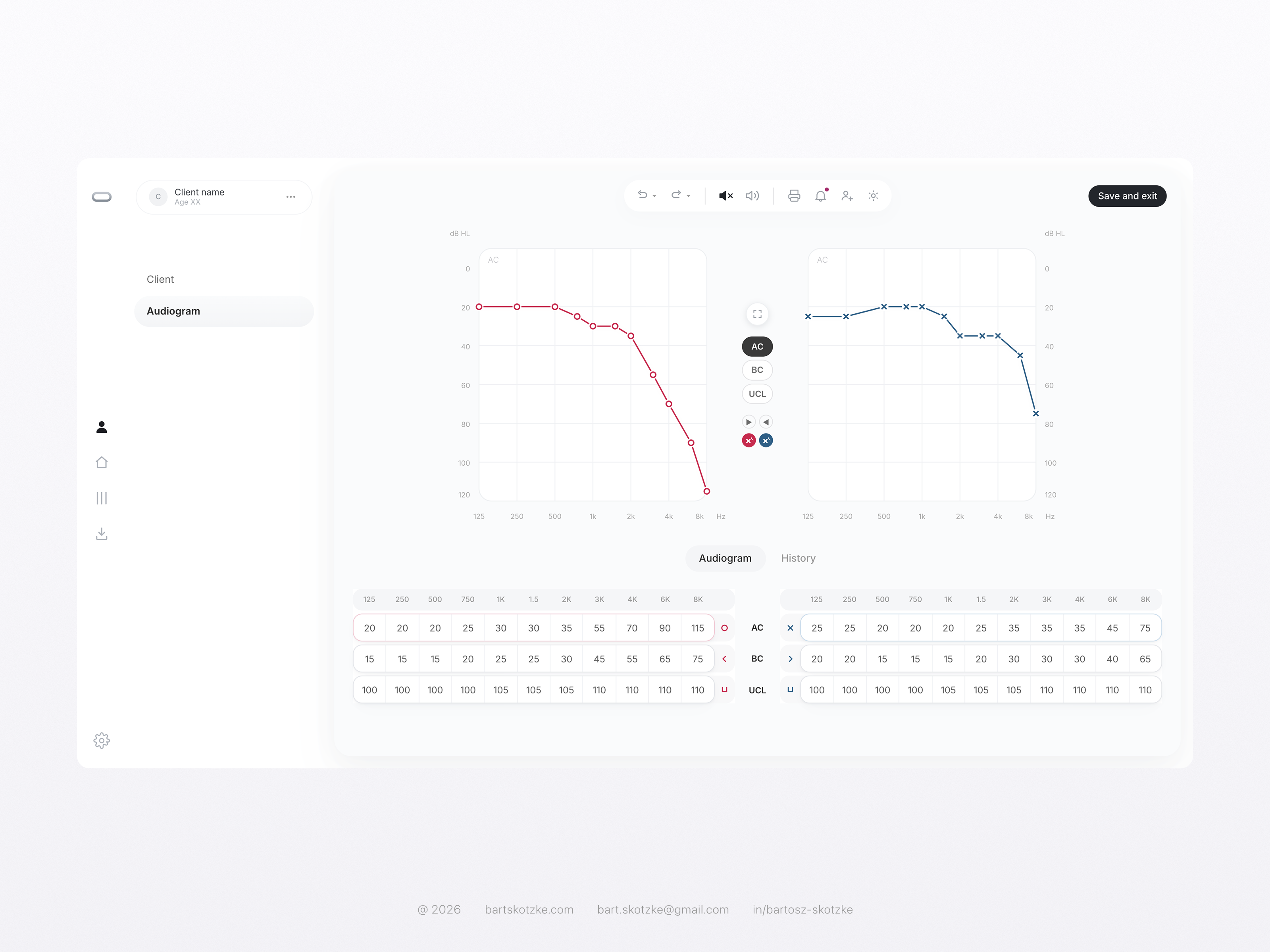 Audiogram - Fitting software app audiograms audiology design desktop figma product product design ui ux