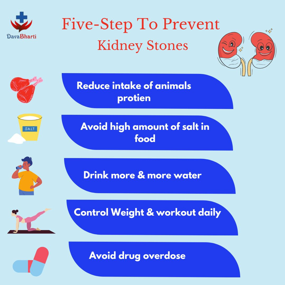 how-to-prevent-kidney-stones-from-recurring