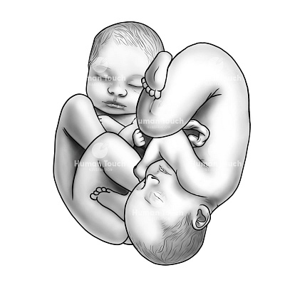 Twins in utero adobe photoshop greyscale gynaecology illustration medical art medical illustration medical imagery midwife midwifery obgyn obstetrics photoshop photoshop painting scientific art scientific illustration twins twins in utero