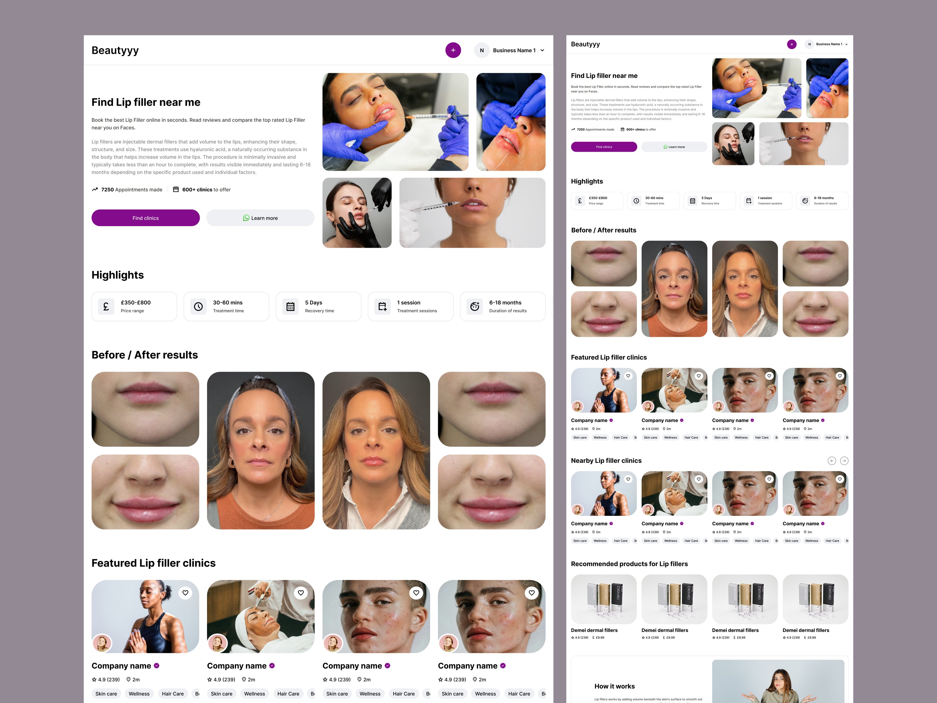 Lip Filler Clinic Website UI/UX Design allergies enhance contours enhancing their shape facial anatomy fine lines have realistic expectations structure