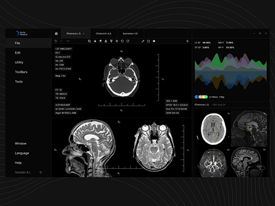 MRI interface design interface medical ui ux