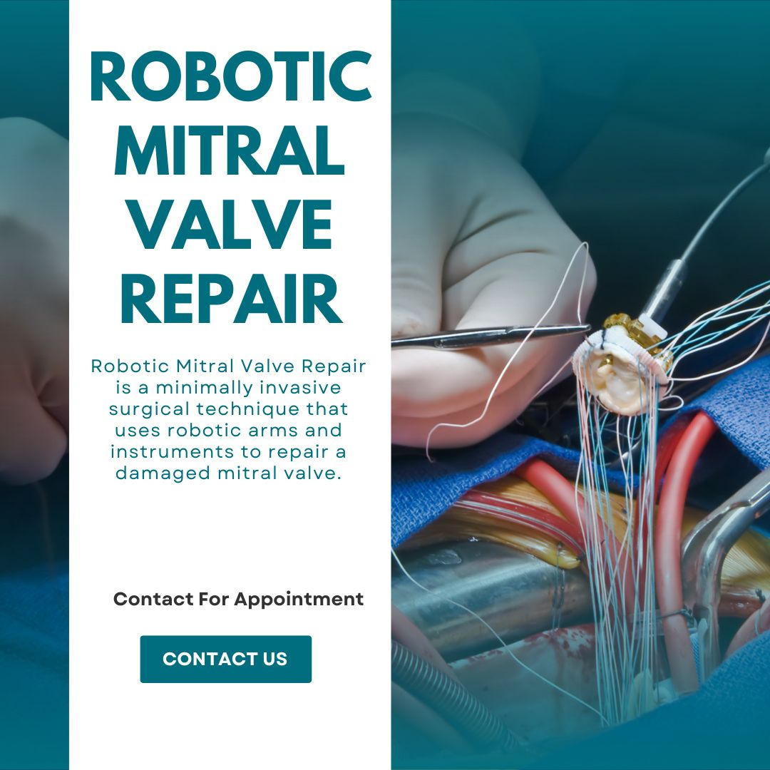 Robotic Mitral Valve Repair by Minimally Invasive Heart Surgery on Dribbble