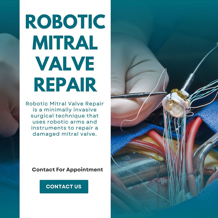 robotic-mitral-valve-repair-by-minimally-invasive-heart-surgery-on-dribbble