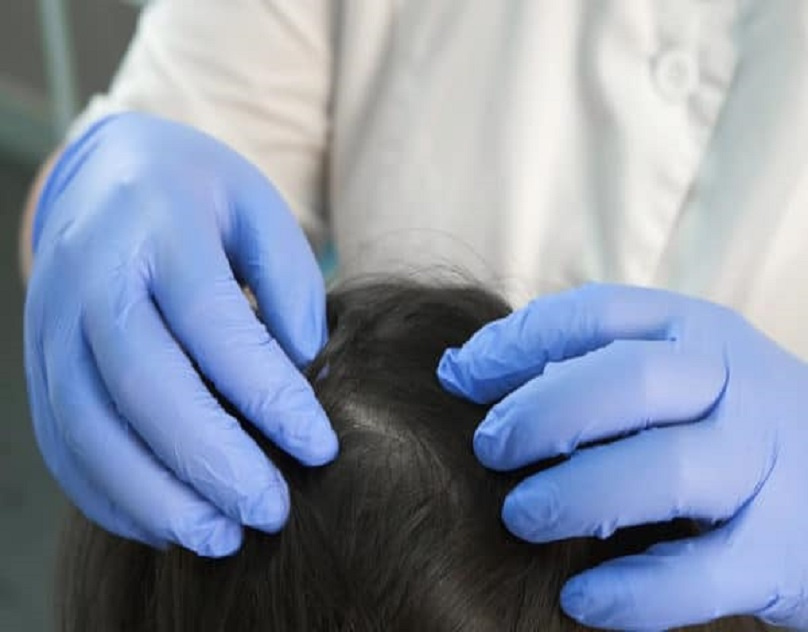 Transform Your Look with Skilled Hair Loss Doctor in Los Angeles by Dr