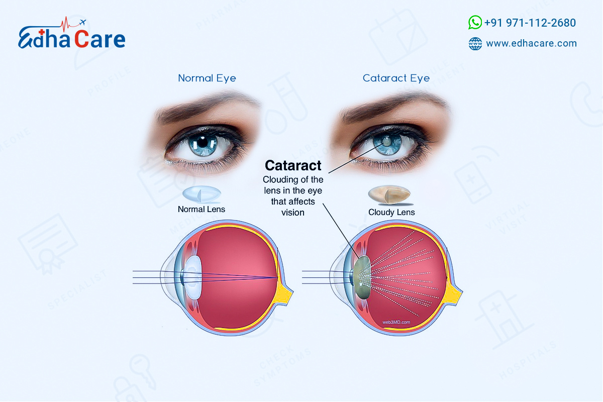 eye-doctors-in-india-by-edhacaredoctor-on-dribbble