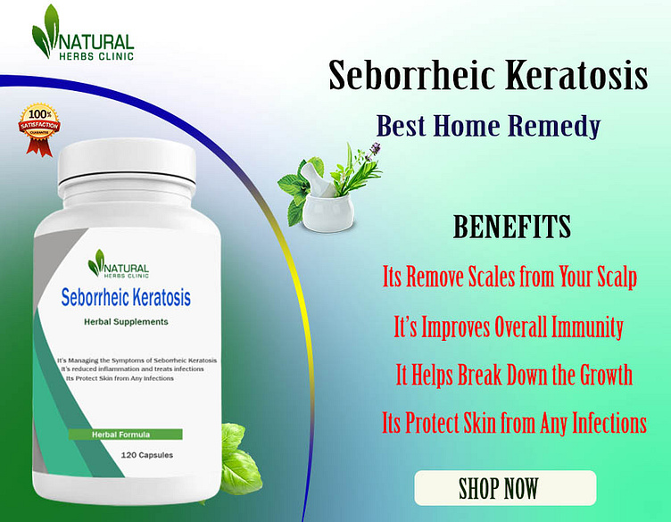 Affected With Seborrheic Keratosis Read About Home Remedies By Jessica Sarah On Dribbble