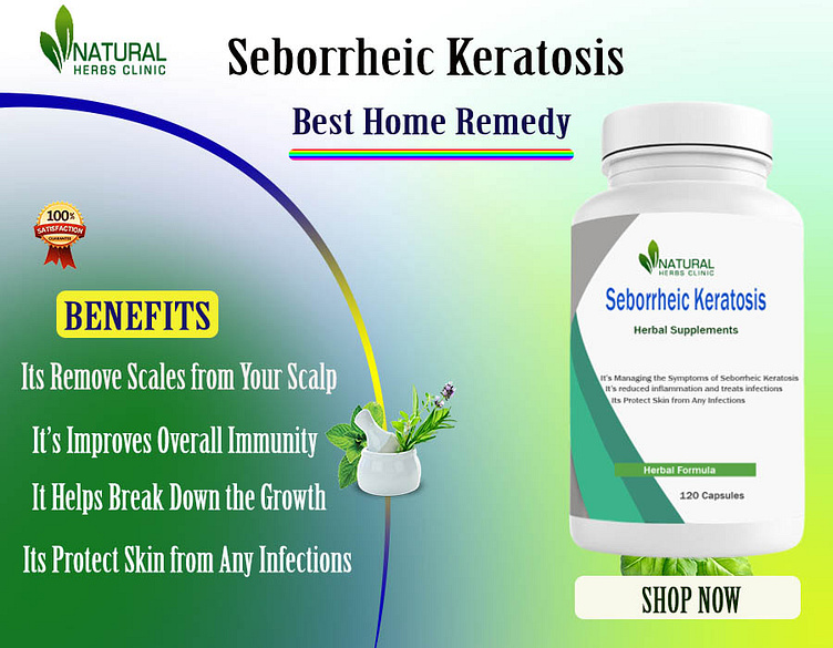 Seborrheic Keratosis Gain Natural Cure With Home Remedies By Jessica