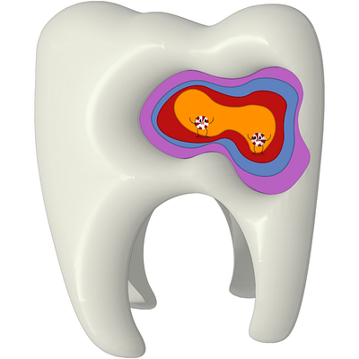 Cavities 3d cavities dentist design graphic design illustration tooth vector