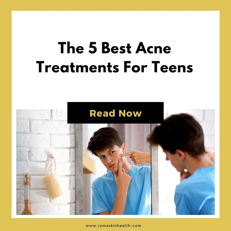 Best Acne Treatment For Teenagers