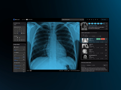 AI Design of a Health Dashboard for Radiology Department 3d animation dashboard dashboard ui data doctors graphic design health health dashboard interface lungs medical data medical ui ml health motion graphics patient radiology ui ux xrays