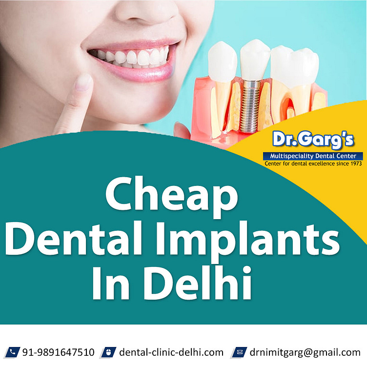 cheap-dental-implants-in-delhi-by-dentalclinic-delhi-on-dribbble