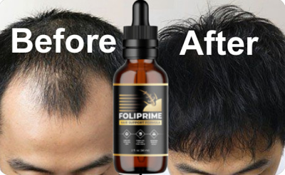 Foliprime Hair Support Formula foliprimehairsupportformula