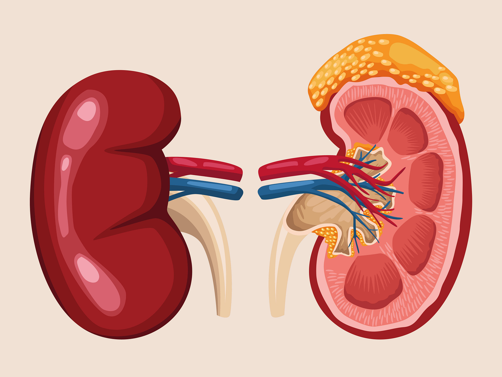 kidney-stone-removal-surgery-in-bangalore-what-you-need-to-know-by