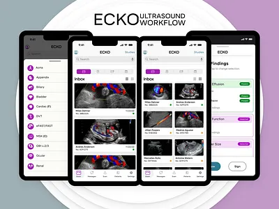 Ultrasound Workflow - Mobile/Tablet/Web application billing experience healthcare imaging interface ultrasound visual workflow