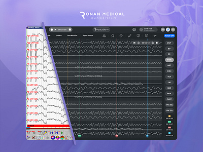 Innovative Medical Dashboard - EEG Records app dashboard gif medical dashboard mobile design nuro ui uiux