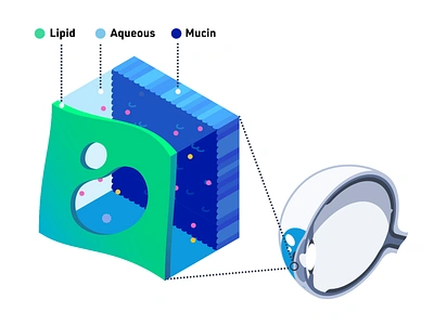 Unstable tear film. JSON web animation. 3d animation app cell disease eye film infographic isometric json lottie medical medicine structure svg tear unstable vector web zoom